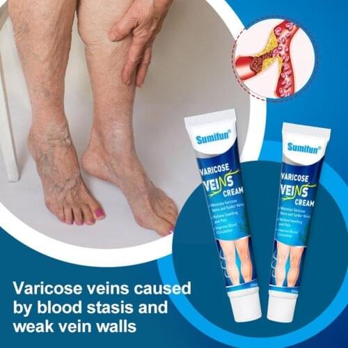 ​20g Varicose Vein Cream Anti-bacterial Effective Red Leg Streak blood Vasculitis Ointment Treatment Repair Raised Phlebiti Z9D9