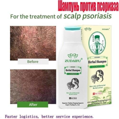 120Ml Zudaifu Psoriasis Eczema Herbal Ginseng Treatment Shampoo Mite Growth Removal Care Repair Hair Antibacterial Serum