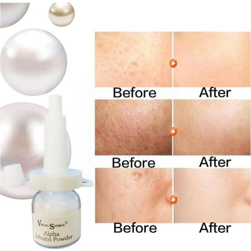 Whitening Essence Oil Control Shrink Pores Repair Whitening Essence Moisturizing C4V2