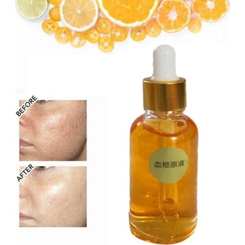 30ml Blood Orange Essence Improve Skin Tone Face Toner Deep Moisturizing Improve Rough Repair Skin After Sun Serum