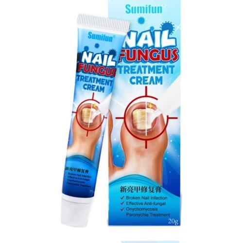 20g Chinese Herbal Toe Nail Fungus Treatment Cream Onychomycosis Paronychia Antibacterial Infection Repair Ointment