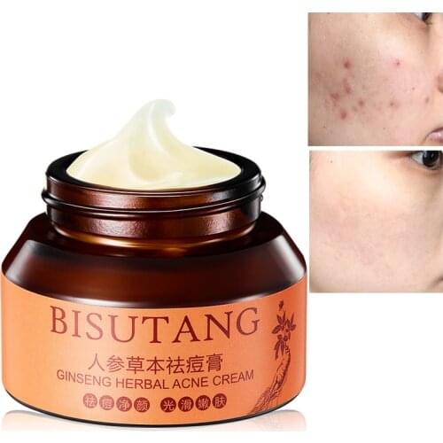 Ginseng Herbal Acne Cream Facial Care Moisturizing Remove Acne Marks Blackheads Shrink Pores Clean Repair Whitening Skincare M