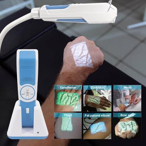 Blue and White Color and Vein Finder Product name vein finder
