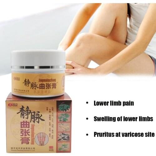 Varicose vein treatment cream natural ointment for varicose vasculitis remedy ointment phlebitis spider pain relief