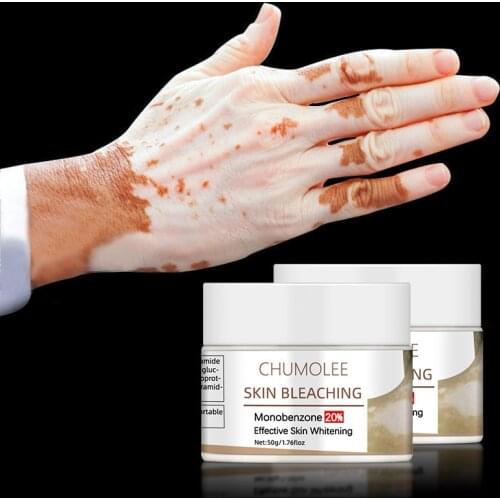 Chumolee Dark Knuckles Remover Eraser Monobenzone Whitening Cream Bleaching Clear Knuckles Cream for Hands Fingers Feet