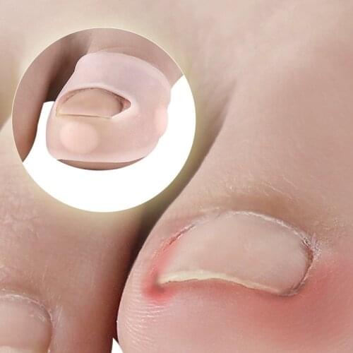 2PCS Silicone Ingrown Toenail Correction Tool Invisible Ingrown Toe Nail Treatment Elastic Straightening Clip Brace