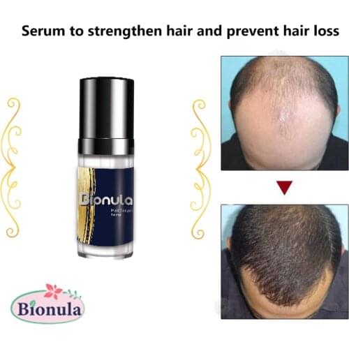 Serum for treating hair loss