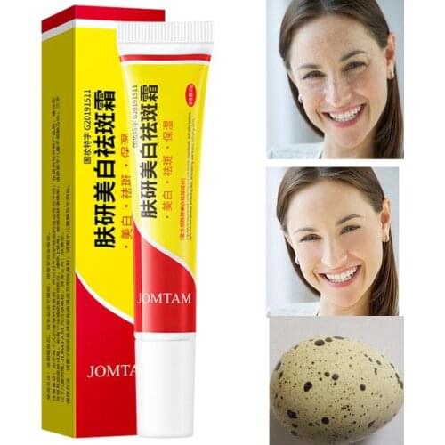 Effective Whitening Freckle Cream Remove Melasma Acne Spot Pigment Melanin Dark Spots Pigmentation Moisturizing Gel Skin Care