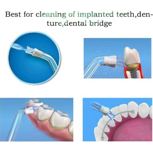 1PCS Plaque Seeker Tip for Waterpik Water Flosser Replacement Random Color A0NC