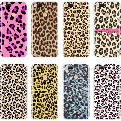 Girl Back Cover For Xiaomi MI A1 A2 Lite Mi5 Mi6 Mi8 Luxury Leopard Phone Case Silicone For Xiaomi Mi 5 5C 5S 5X 6 6X Plus 8 SE