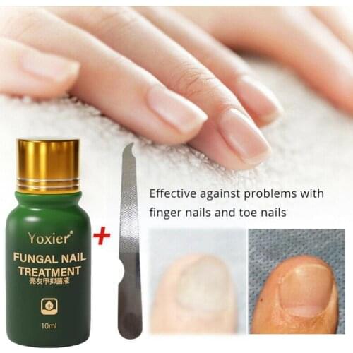 10ml Fingernail Whitening Serum Polishing Liquid Foot Fungal Repair Nail Treatment Bright Essence J6Q5
