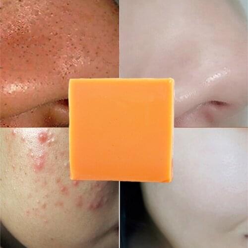 100g Turmeric Essential Oil Soap Cleansing Nourishing Oil-control Whitening Acne Treatment Hair Shampoo Body Face Soap Skin Care