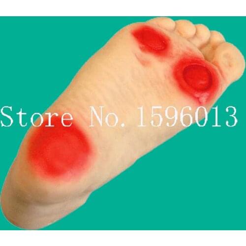 HOT Diabetic Foot Nursing Simulator, Diabetic foot care model