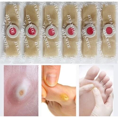 30Pcs Corn Plaster Canopy Patch Medical Adhesive Plaster Corn Patch Medical Plaster Corn Removal