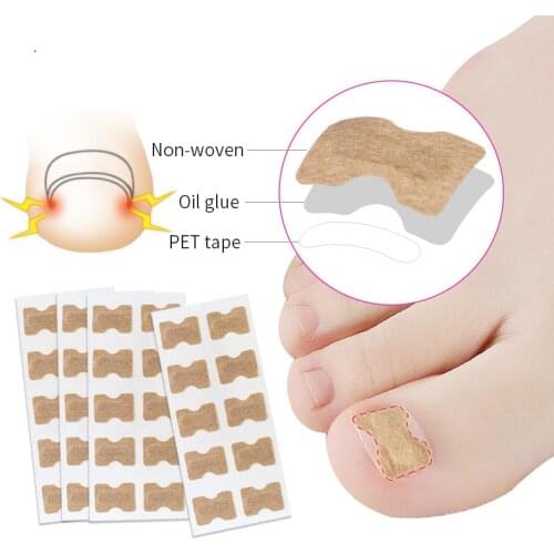 1-5Sheet Nail Ingrown Correction Sticker Treatment Paronychia Correction Pedicure Elastic Force Sticker Pedicure Foot Care Tool