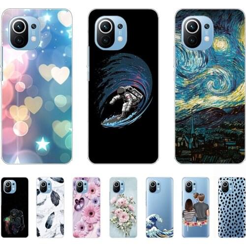 For Xiaomi Mi 11 Case Tpu Silicon Flexible Luxury Shell Phone Cover on Mi 11 Pro Anti-knock Personality Fundas Coque Etui Bumper