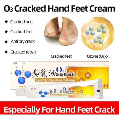 Hand Foot Crack Repair Cream Treatment Heel Peeling Anti Dry Care Antibacterial Ointment Ozone technology 20g