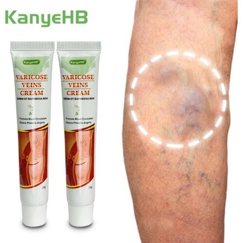 2pcs KanyeHB New Varicose Veins Treatment Cream Varication Ointment Herbal Extracts Potent Non Irritating Varicocele Cream A640