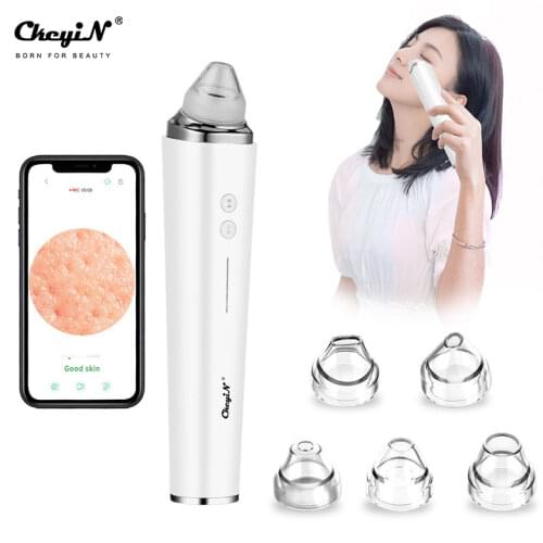 Usb Rechargeable Wifi Visual Blackhead Remover Vacuum Suction Pore Cleaner 20X Magnifier Camera Acne Removal Cleaning Tool