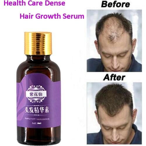 20ml Fast Hair Growth Faster Grow Hair Regrowth For Men Women Pure Natural Hair Loss Products Pilatory Treatment Anti-Hair Loss