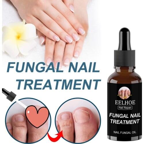 10/20/30/50ml Effective Fungus Removal Oil Anti Fungal Fungus Nail Fungus Liquid Repair Liquid Removal TSLM1