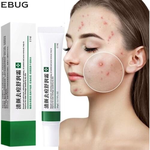 Effective Acne Removal Cream Acne Treatment Fade Acne Spots Oil Control Shrink Pores Whitening Moisturizing Acne Cream Skin Care