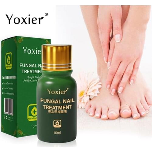 Effective Fungal Nail Treatment Herbal Formula Repair Anti Infection Paronychia Onychomycosis Improve Thickening Atrophy Shed