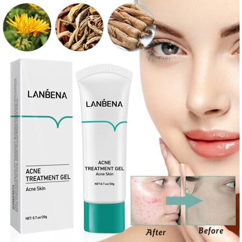 LANBENA Acne Treatment Whitening Cream Blackhead Repair Gel Oil Control Shrink Pore Scars Moisturizing Skin Skin Care Korea