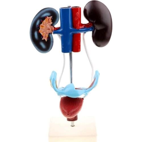 Female Genitourinary System Model Genital Model Human Anatomy 4 Parts Kidney Ureter Uterus Anatomical Organ Medical Teaching