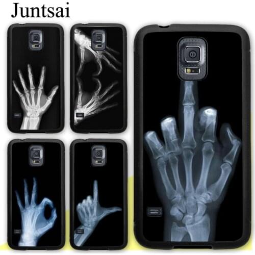 X-ray Hand Bones Case For Samsung Galaxy S20 Plus S9 S10 Note 20 Ultra A50 A70 A51 A71 A21S A20e A31 M31 M21