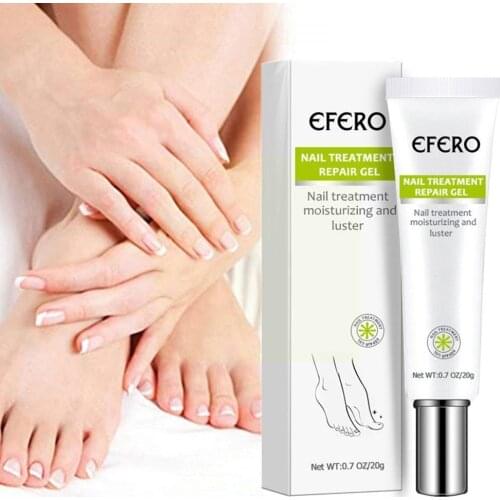Herbal Fungal Nail Treatment Essence Nail Foot Toe Onychomycosis Paronychia Infection Anti Fungus Nail Foot Repair Gel Remo G5C9