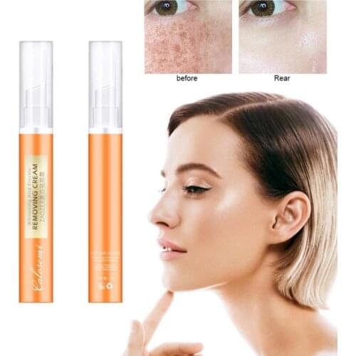 Acne Treatment Freckle Remove Cream Anti Acne Cream Pimple Scar Dark Spots Removal Whitening SkinCare Blackhead Remove TSLM1