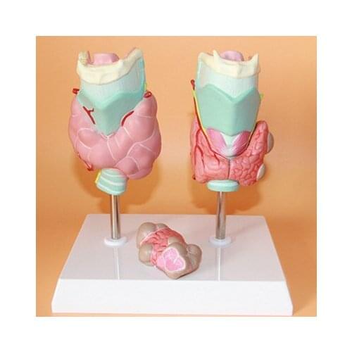 Thyroid pathology model Thyroid tumor Throat Thyroid anatomy model