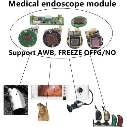 SDI Medical Camera Module White Balance AWB Freeze Opens and Closes Electronic Magnification with One Click 60fps Hysteroscopy