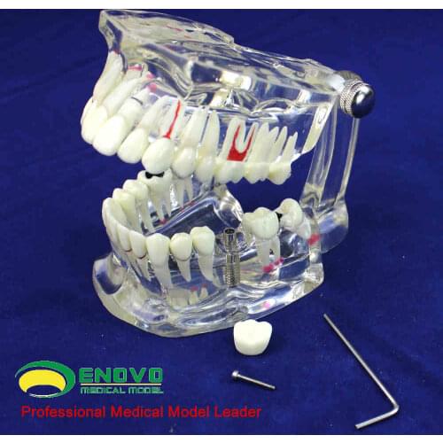 Oral and dental models of oral cavity diseases