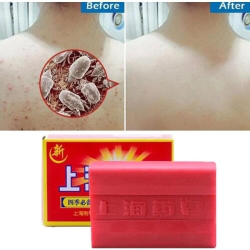 90g Red China Medicated Soap Conditions Acne Psoriasis Seborrhea Eczema Anti Fungus Bath Healthy Soap Slimming Body Cream