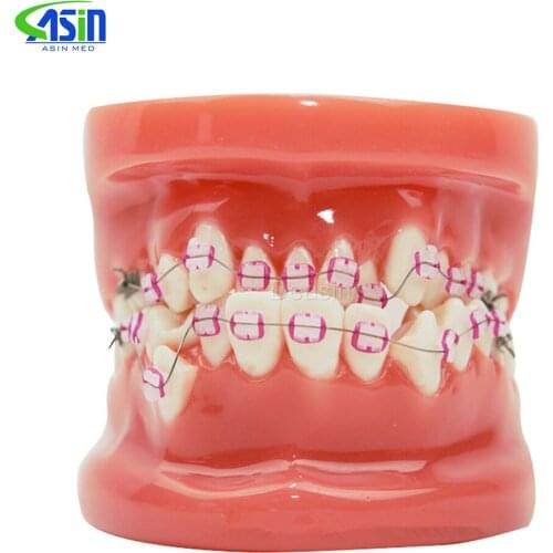 Orthodontic tooth model with Ceramic bracket model Doctor patient communication teaching model dental materials