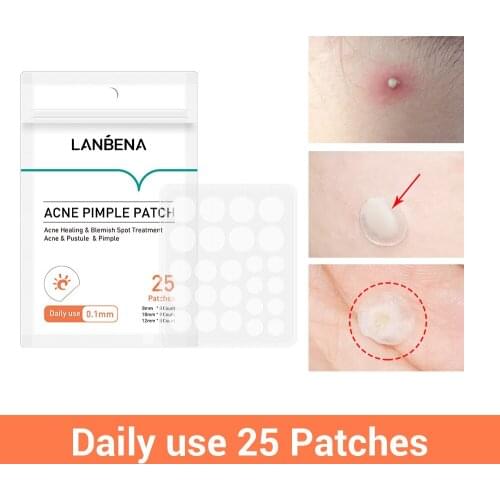 LANBENA Day Acne Pimple Patch Invisible Acne Stickers Blemish Treatment Acne Master Pimple Remover Beauty Tool Skin Care