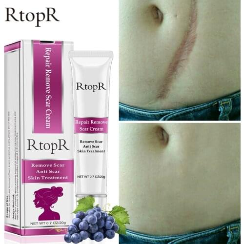 RtopR Acne Scar Stretch Marks Remover Cream Skin Repair Face Cream Acne Spots Acne Treatment Blackhead Whitening Cream Skin Care