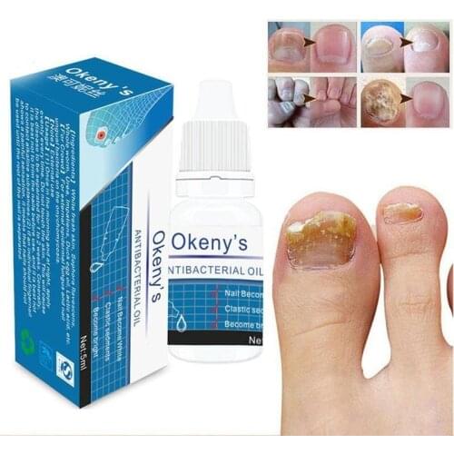 5ML/1Bottle Remedy For Nail Fungus Treatment Feet Care Essence Whitening Toe From Nail Foot Fungus Remove Gel Antifungal Cream