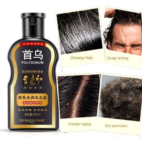 WWW.AQISI.COM Anti-dandruff Shampoos
