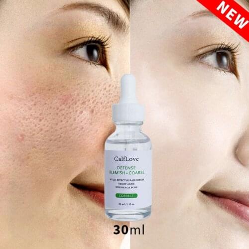 Hot sale30ml Salicylic Acid Solution Removes Acne Face serum Shrinks Pore Moisturizing Essence Fade Spot Brighten Face Skin Care