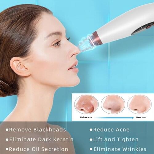 Blackhead Skin Care Face Deep Pore Acne Pimple Removal Vacuum Suction Facial Diamond Beauty Tool Remover Blackhead device