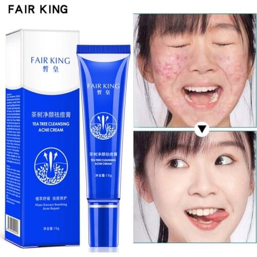 15g Acne Treatment Blackhead Remover Cream Plant Acne Treatment Ointment Blemish Cream Moisturizing Control Oil Skin Care