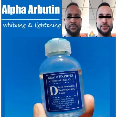 Original Alpha Arbutin Skin Super Whitening Dark Lightening Brightening Serum Kojic Acid Serum Bleaching Cream Face Beauty Care