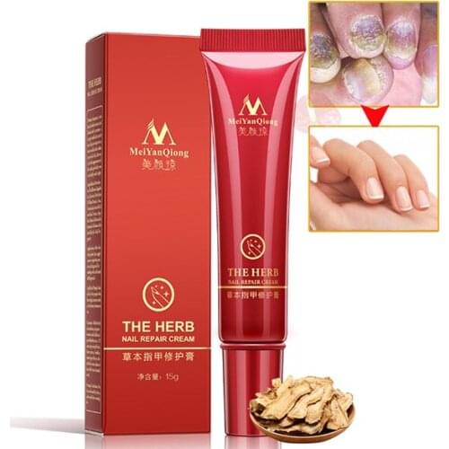 Nail Foot Protector Herbal Toe Nail Treatment Repair Cream Anti Fungal Infection Skin Care Nail Care Tools
