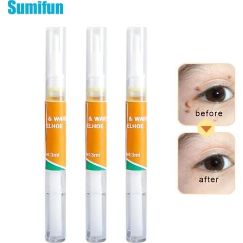 1/3 pcs Skin Tag Remover Wart Cream Painless Remove Mole Genital Wart Fast Removal Papillomas Mole Natural Herbal Plaster 3ml