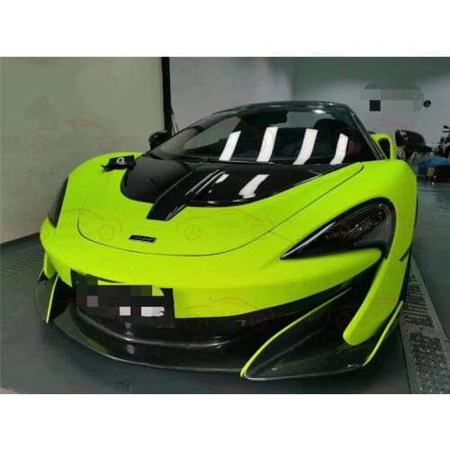 FOR McLaren 540C 570s 570gt 600lt carbon fiber hood, hood body kit auto parts