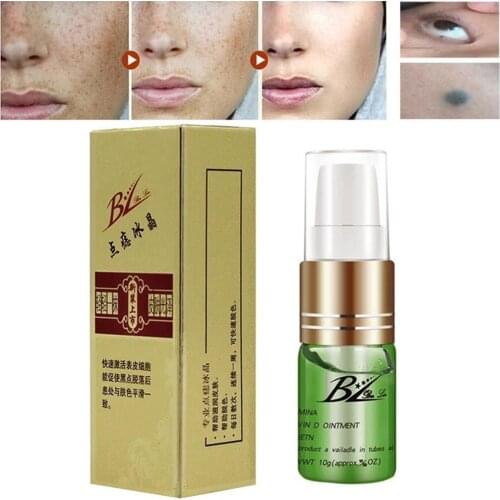 Mole & Skin Tag Repair Solution Painless Removal Spot Moles Tags Wash Oil Tattoo Fluid Face Freckle Warts Treatment Dark Sk F5E6