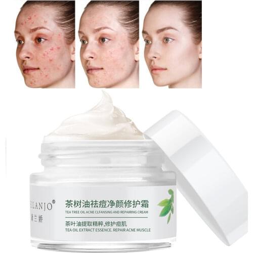 Tea tree oil acne cream 35g herbal cream Acne Treatment Power Effective Acne Removal Fade Acne Spots Oil Control Shrink Pores